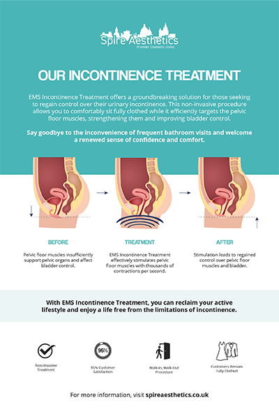 image of how urge incontinence Wraysbury treatment works