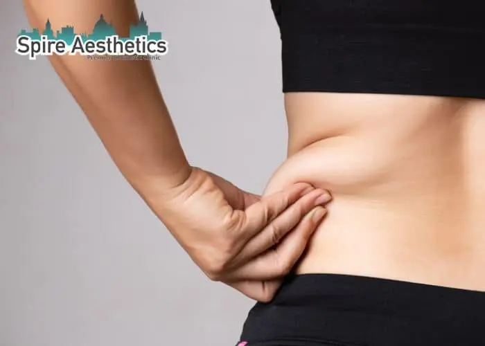 Image of woman pinching fat on their hips Wraysbury. Fat Freezing treatment